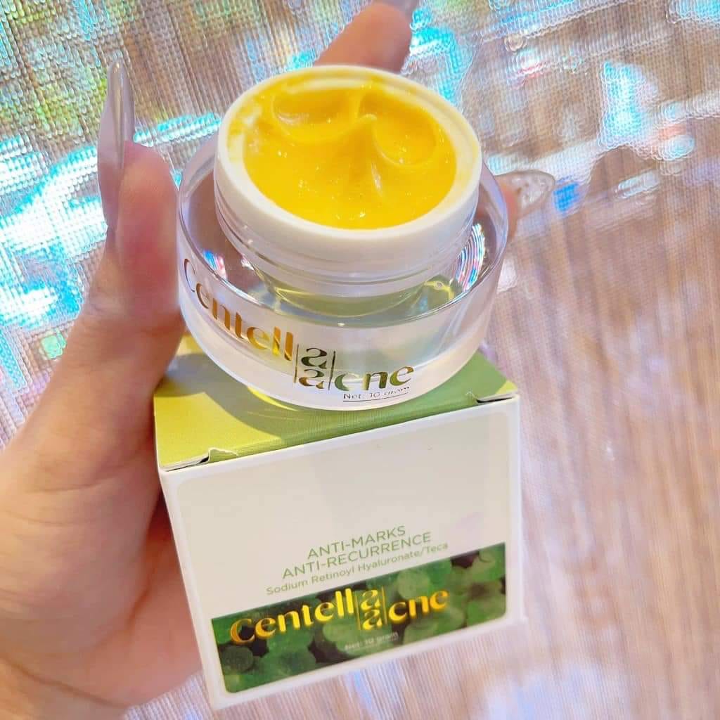 Kem Face Rau Má Thanh Tô Giảm Mụn Jiuhe Centella Acne