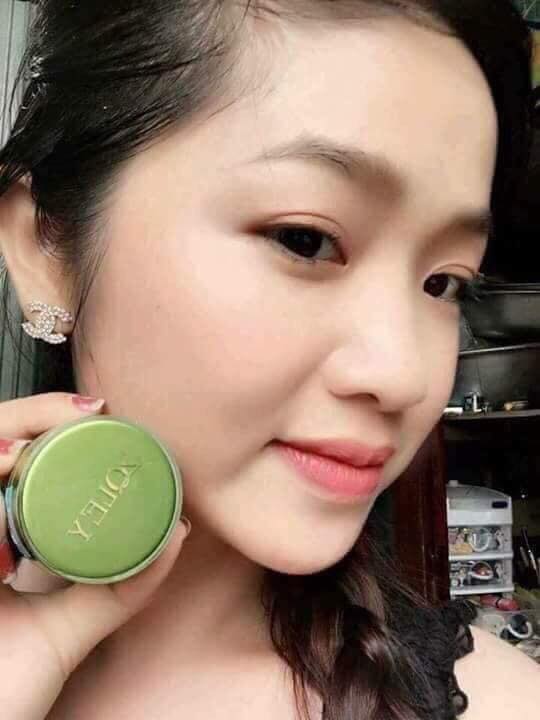 Kem face Zoley Màu Xanh đặc trị rất hiệu quả