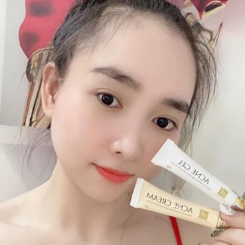 Bộ đôi GEL và CREAM Phương Anh cứu tinh của con gái mình 😝