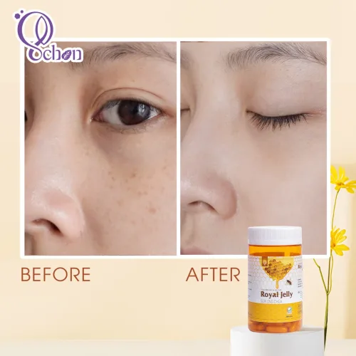 Có viên sữa ong chúa schon – tuổi tác chỉ là những con số!