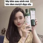 Combo bộ dầu gội xả Weilaiya mọc tóc chiết xuất gừng xả