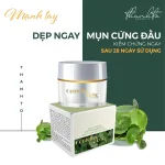 Combo Giảm Mụn Kem Face Rau Má Centella Ance Jiuhe và Serum Acne Extra Jiuhe Thanh Tô Cosmetics