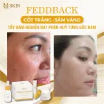 Combo Kem Face Sâm Vàng MQ Skin