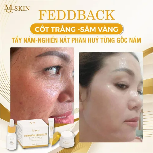 Combo Kem Face Sâm Vàng MQ Skin