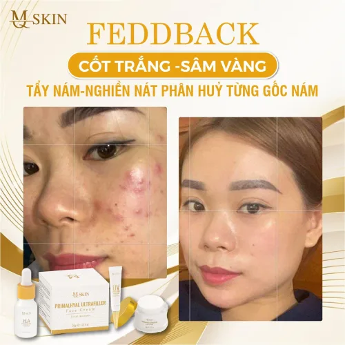 Combo Kem Face Sâm Vàng MQ Skin