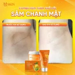 Combo Kem Tẩy Lông + Kem Thâm Nách MQ Skin Sâm Chanh Mật