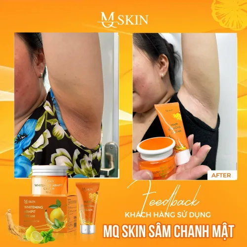 Combo Kem Tẩy Lông + Kem Thâm Nách MQ Skin Sâm Chanh Mật