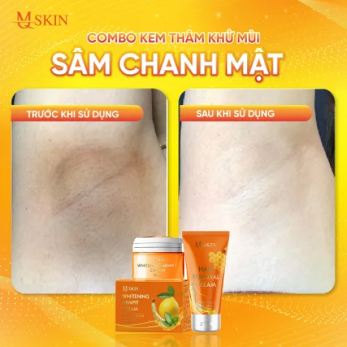 Combo Kem Tẩy Lông + Kem Thâm Nách MQ Skin Sâm Chanh Mật giảm thâm nách