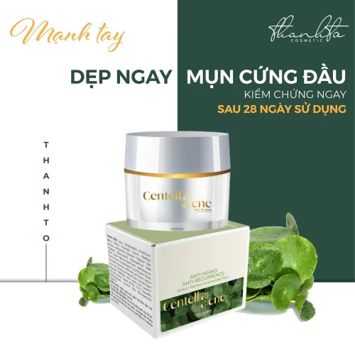 Dẹp ngay mụn cứng đầu sau 28 ngày sử dụng với Kem Face Mụn Rau Má Jiuhe Centella Acne