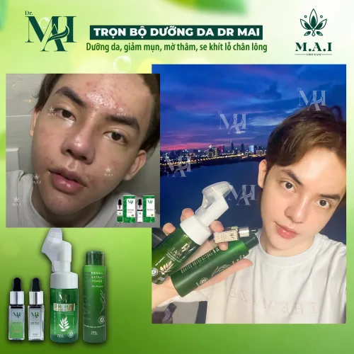Dr Mai – dưỡng da giảm mụn không bị phụ thuộc