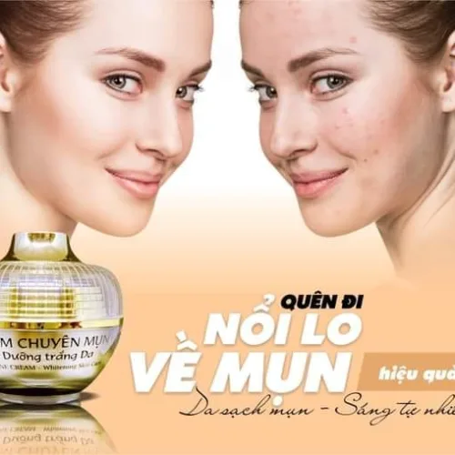 Kem Face Chuyên Mụn Trắng Da Huỳnh Đỗ