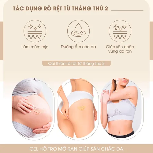 Kem Rạn Da The Recovery Stretch Care