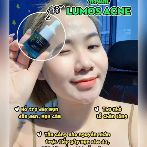 Lumos Acne giúp da tìm lại phiên bản hoàn hảo nhất mụn vết thâm nám da sẹo rỗ