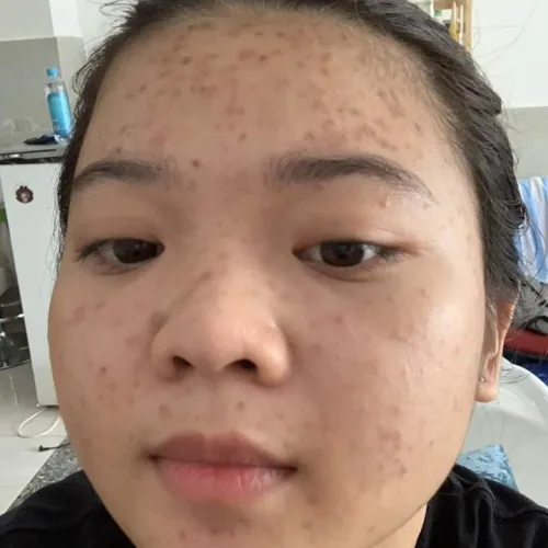 Muốn da đẹp thì phải chăm sài Dr Mai