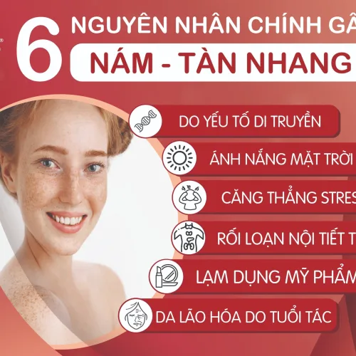 Nguyên nhân chính gây nám tàn nhang