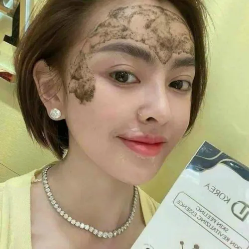 Peel Da Vi Tảo Retinol Số 1 Dành Cho Da Nhạy Cảm Trang Nemo