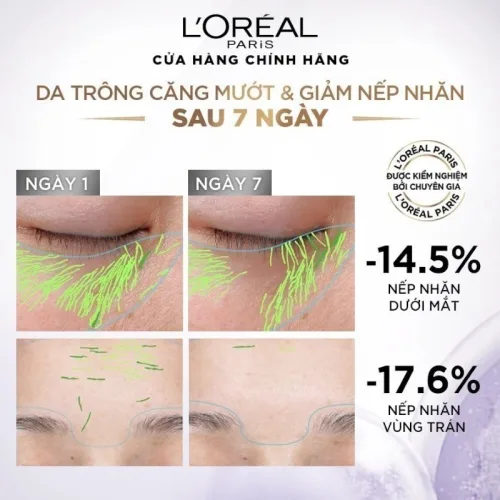 Serum Loreal Paris Revitalift Hyaluronic Acid 1.5% Hyaluron Cấp Ẩm Sáng Da 30ml