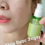 Serum Tái Tạo Da Không Sưng MQ Skin Phiên Bản Cao Cấp