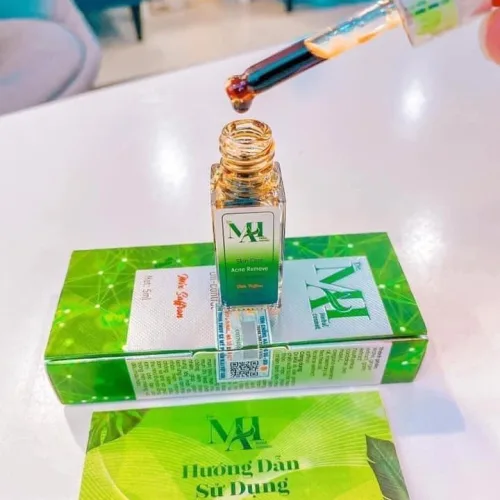 Siêu phẩm trị mụn gây sốt cộng đồng mạng – bạn đã thử chưa?