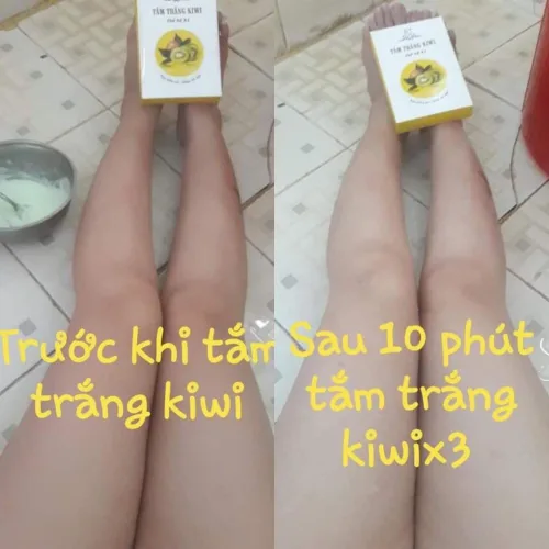 Tắm trắng da rõ rệt chỉ 85k cho 3 lần sử dụng "giải quyết" làn da đen sạm của bạn