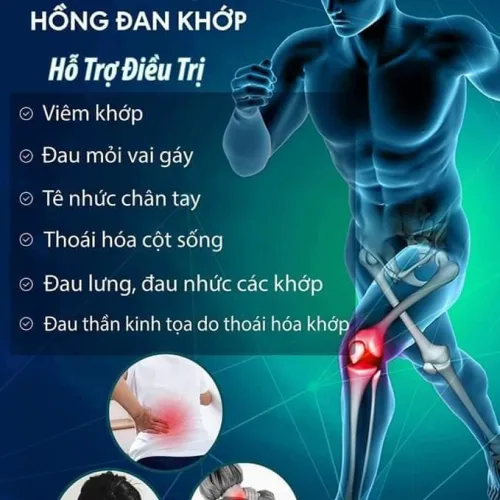 Viên uống hồng đan khớp ĐÔNG Y HỒNG TÂM vị cứu tinh cho những người bệnh khớp
